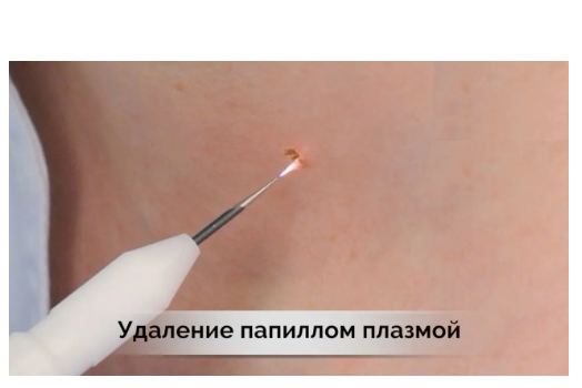 8d717e09-ceaf-11ec-ac9a-166b0be12ee5_1